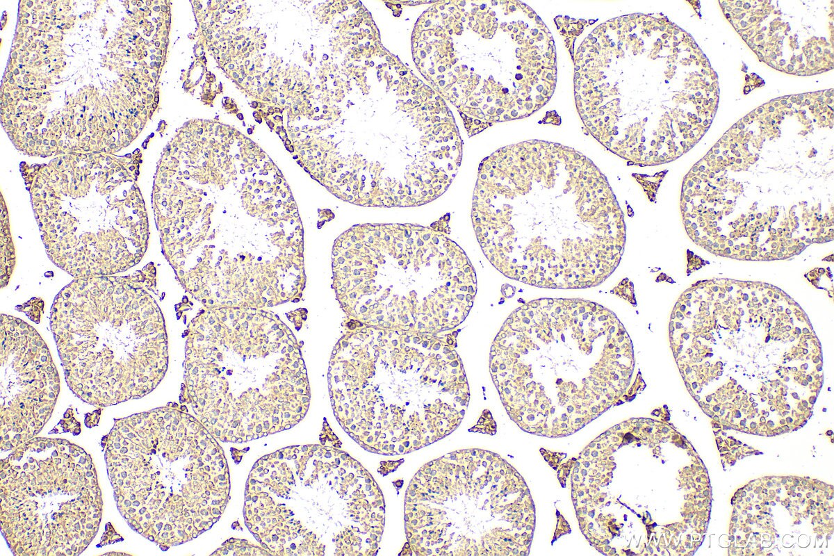 Immunohistochemistry (IHC) staining of mouse testis tissue using MAGEB3 Polyclonal antibody (18000-1-AP)