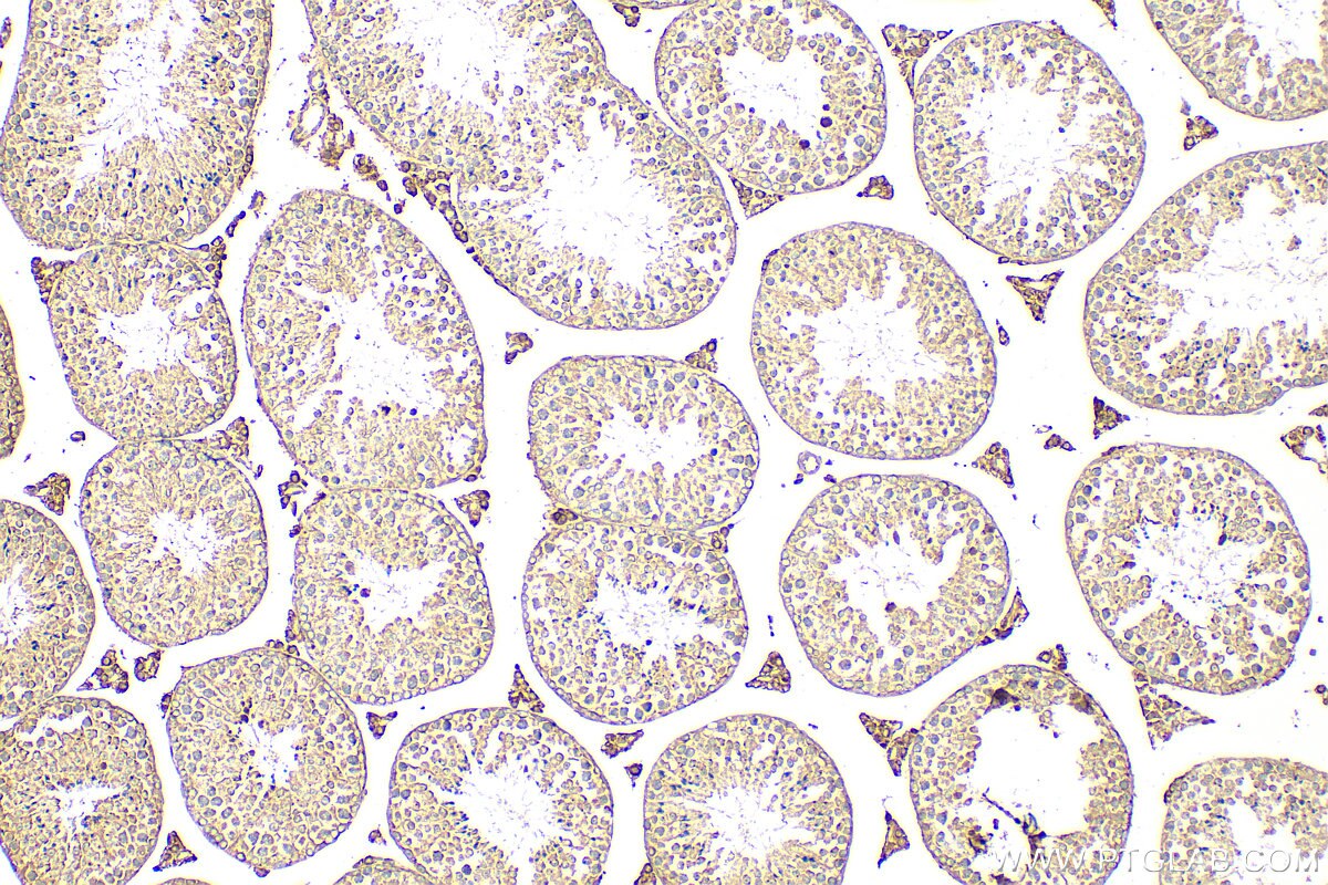 IHC staining of mouse testis using 18000-1-AP