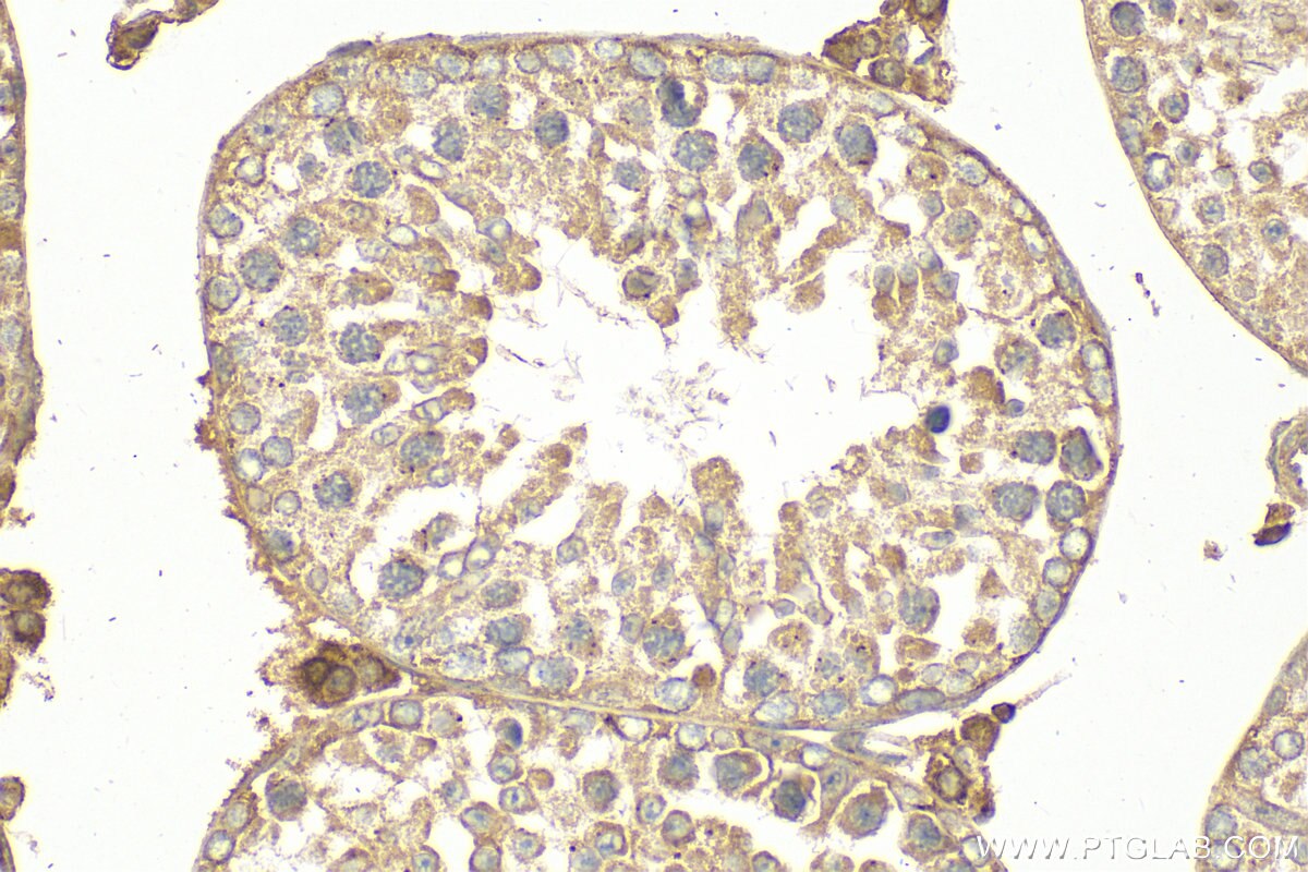 Immunohistochemistry (IHC) staining of mouse testis tissue using MAGEB3 Polyclonal antibody (18000-1-AP)