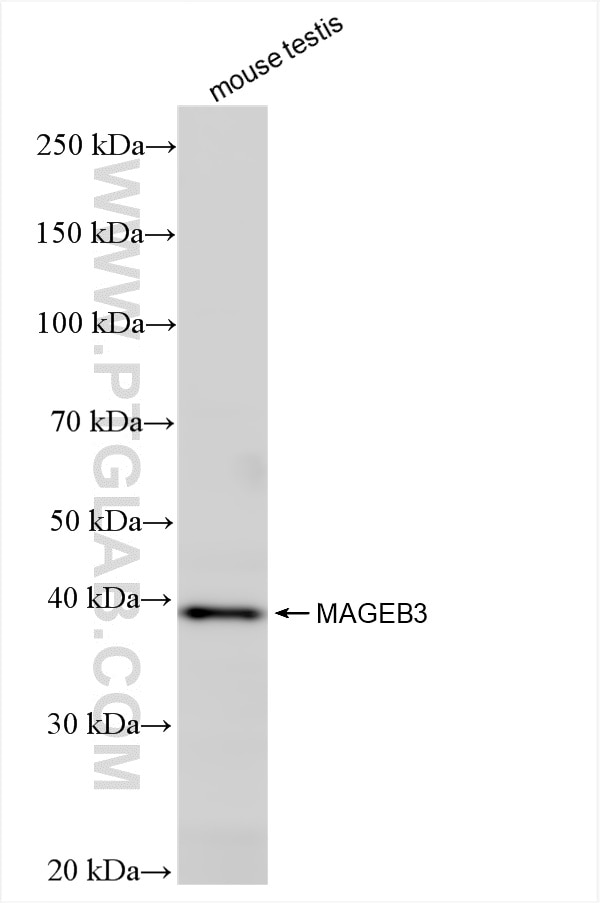 MAGEB3