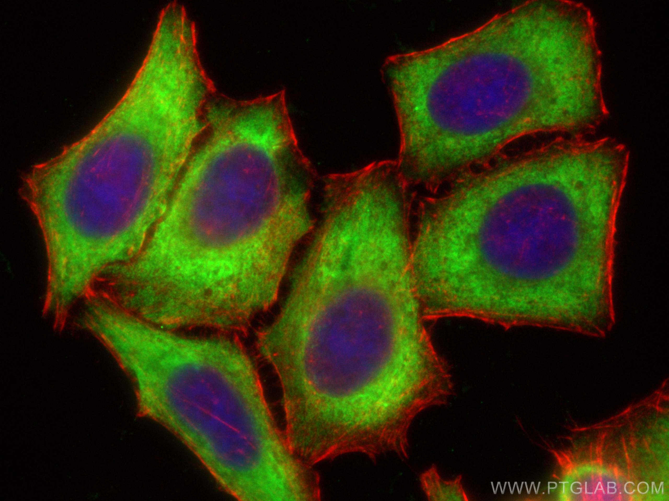 Immunofluorescence (IF) / fluorescent staining of HepG2 cells using MAGEB4 Polyclonal antibody (12786-2-AP)