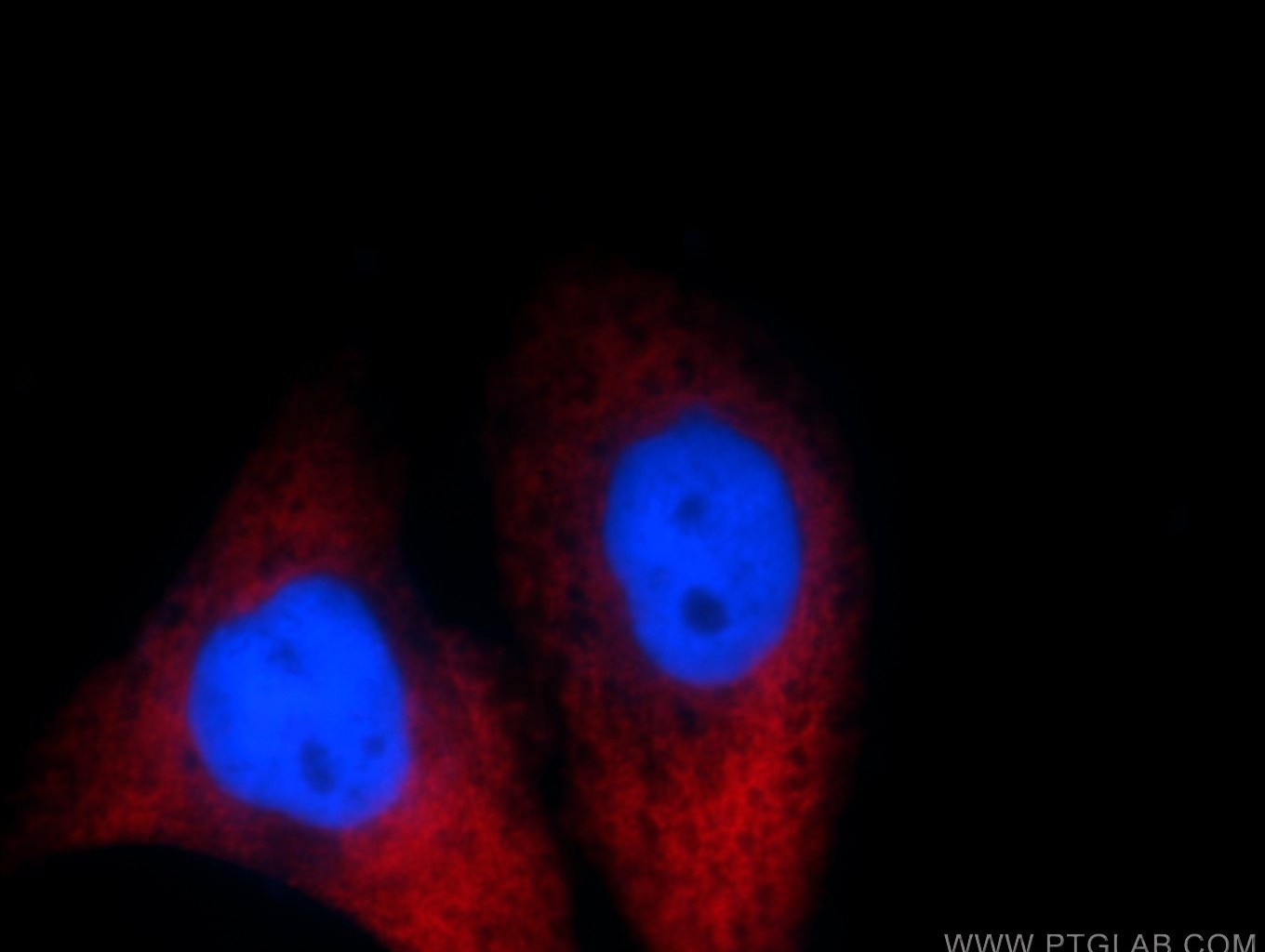 Immunofluorescence (IF) / fluorescent staining of HepG2 cells using MAGEB4 Polyclonal antibody (12786-2-AP)
