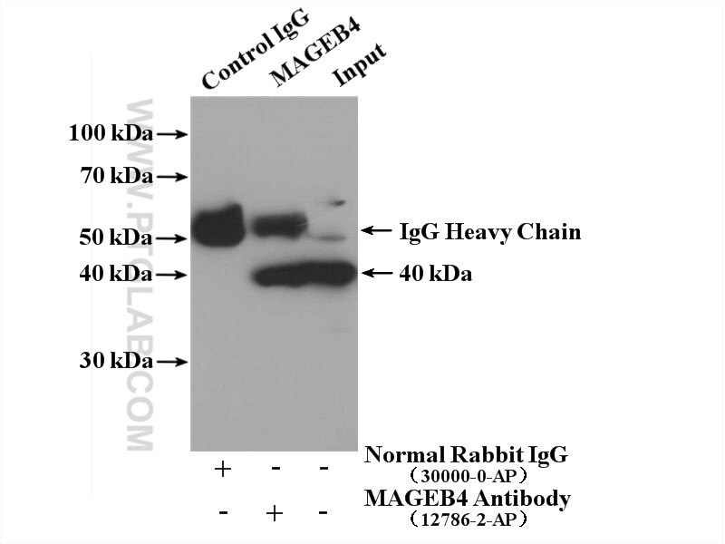 Immunoprecipitation (IP) experiment of K-562 cells using MAGEB4 Polyclonal antibody (12786-2-AP)