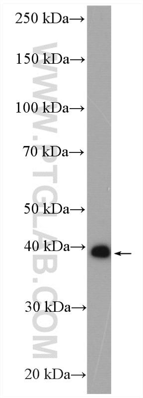 Western Blot (WB) analysis of human testis tissue using MAGEB4 Polyclonal antibody (12786-2-AP)