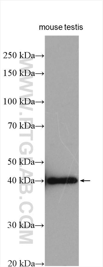 Western Blot (WB) analysis of various lysates using MAGEB4 Polyclonal antibody (12786-2-AP)