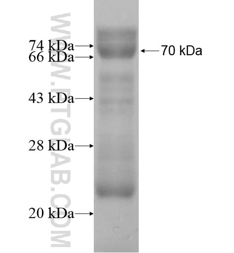 MAGEB6 fusion protein Ag12420 SDS-PAGE