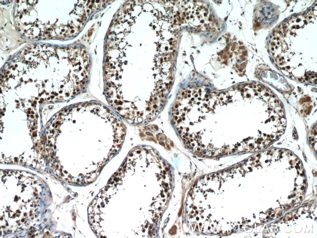 Immunohistochemistry (IHC) staining of human testis tissue using MAGEC2 Polyclonal antibody (10280-1-AP)
