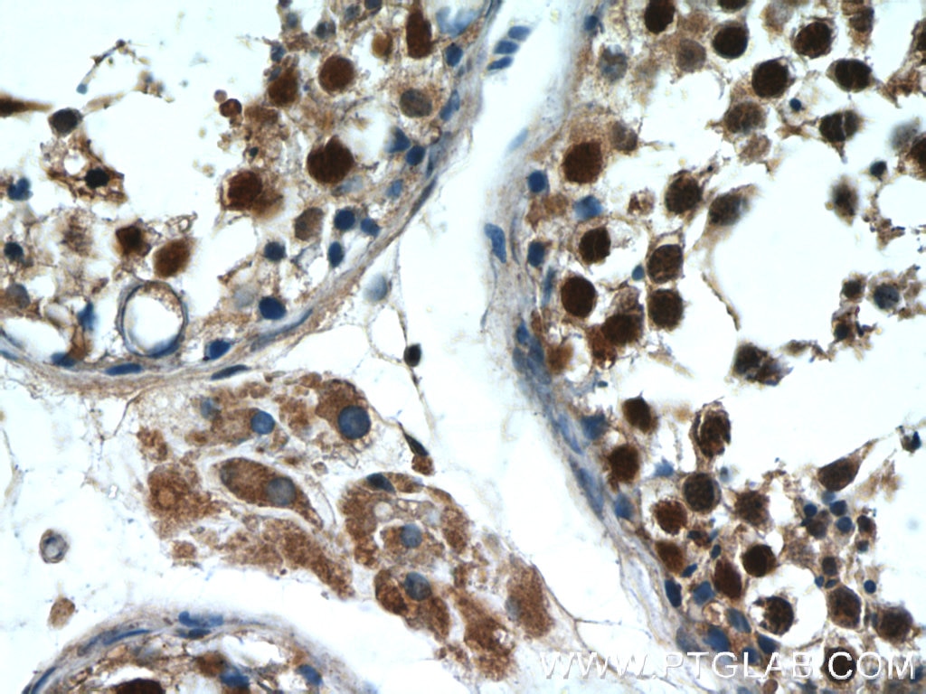 IHC staining of human testis using 10280-1-AP