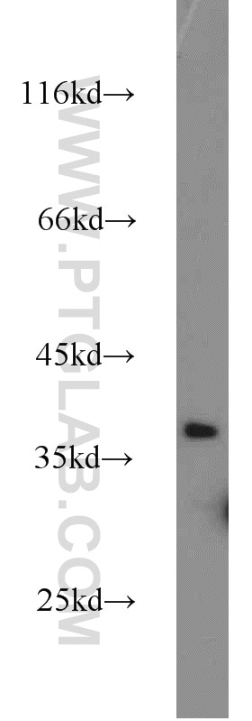 Western Blot (WB) analysis of HEK-293 cells using MAGEC2 Polyclonal antibody (10280-1-AP)