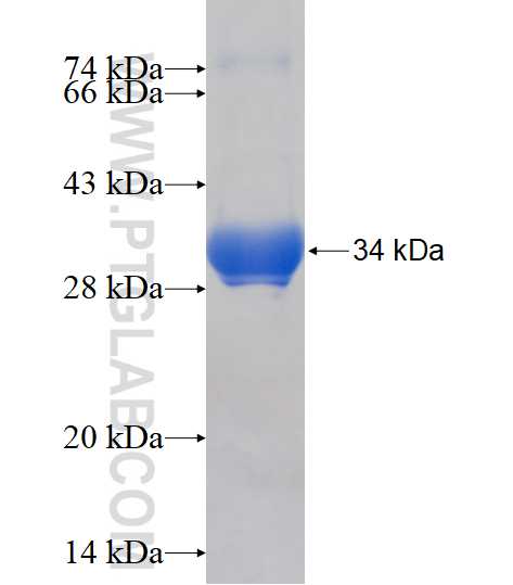 MAGEC2 fusion protein Ag17423 SDS-PAGE