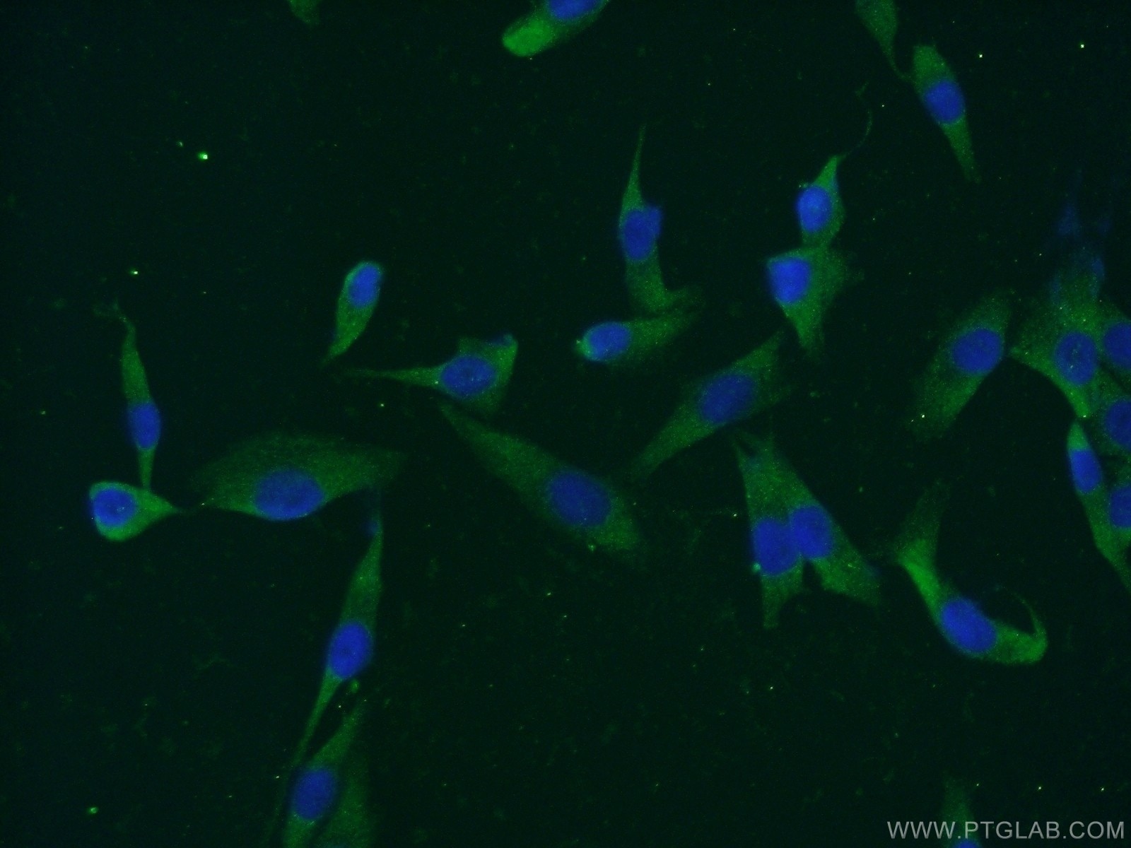 Immunofluorescence (IF) / fluorescent staining of A375 cells using MAGEC3 Polyclonal antibody (21491-1-AP)