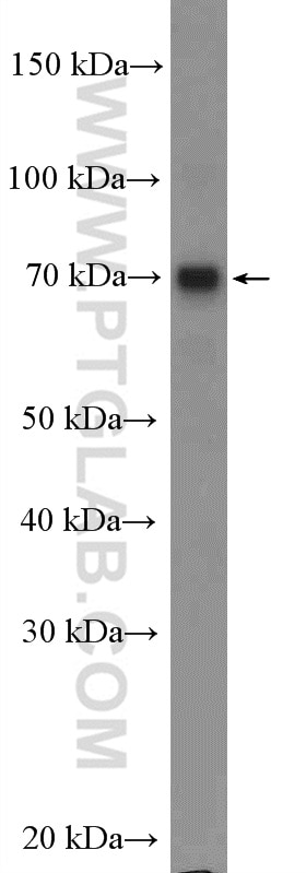 Western Blot (WB) analysis of A375 cells using MAGEC3 Polyclonal antibody (21491-1-AP)