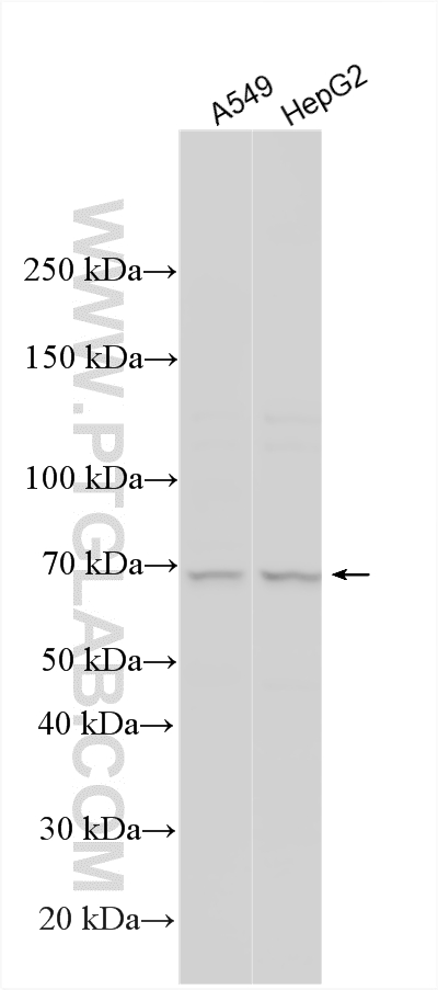 Western Blot (WB) analysis of various lysates using MAGEC3 Polyclonal antibody (21491-1-AP)