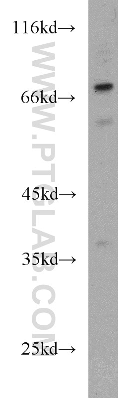 Western Blot (WB) analysis of mouse thymus tissue using MAGEC3 Polyclonal antibody (21491-1-AP)