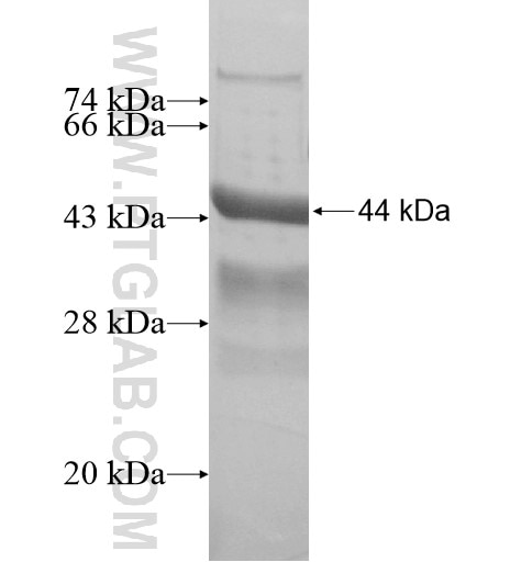 MAGEC3 fusion protein Ag15819 SDS-PAGE