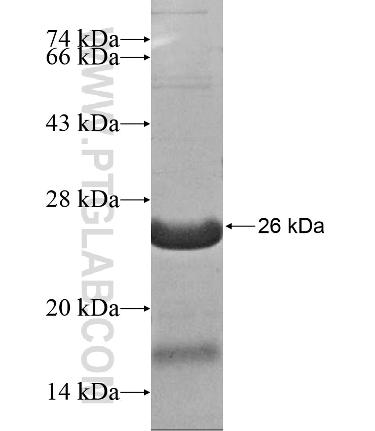 MAGEC3 fusion protein Ag16983 SDS-PAGE