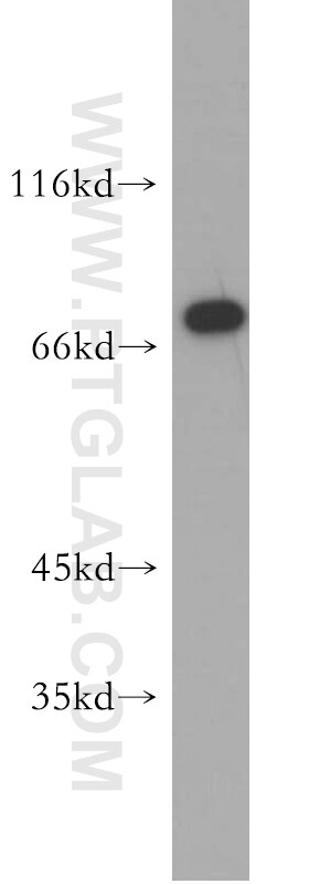 Western Blot (WB) analysis of HeLa cells using MAGED1 Polyclonal antibody (11539-1-AP)