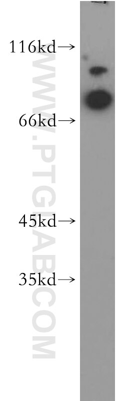 WB analysis of HEK-293 using 11539-1-AP