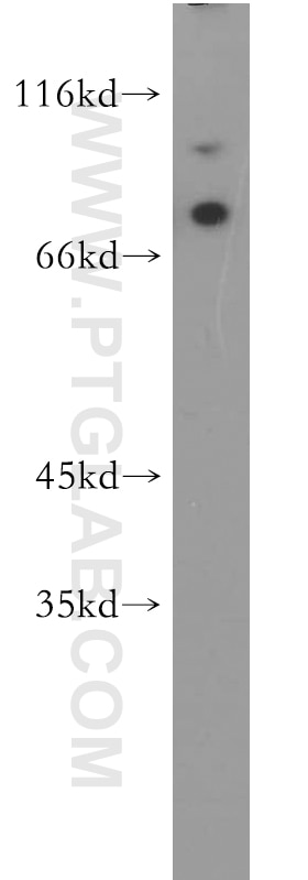 Western Blot (WB) analysis of HEK-293 cells using MAGED1 Polyclonal antibody (11539-1-AP)