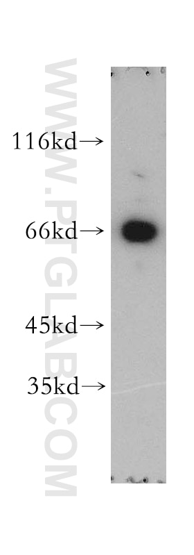 Western Blot (WB) analysis of Apoptosised HeLa cells using MAGED1 Polyclonal antibody (11539-1-AP)