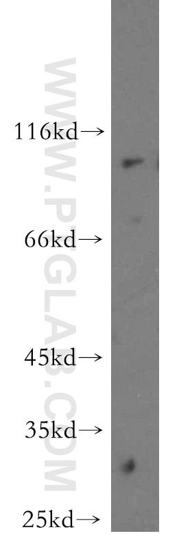 Western Blot (WB) analysis of human brain tissue using MAGED1 Polyclonal antibody (11539-1-AP)