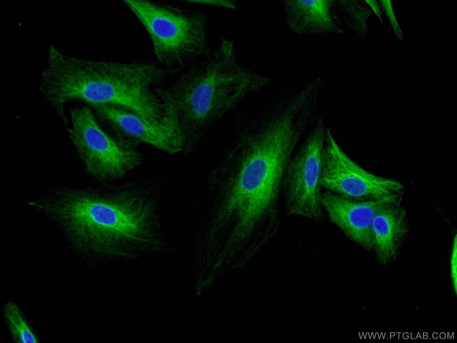 Immunofluorescence (IF) / fluorescent staining of A549 cells using MAGED1 Polyclonal antibody (22053-1-AP)