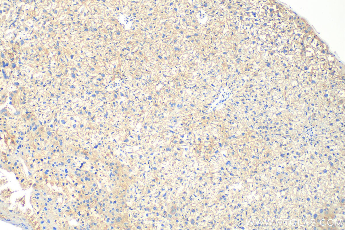 Immunohistochemistry (IHC) staining of mouse placenta tissue using MAGED1 Polyclonal antibody (22053-1-AP)