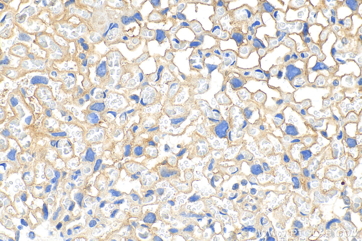 Immunohistochemistry (IHC) staining of mouse placenta tissue using MAGED1 Polyclonal antibody (22053-1-AP)