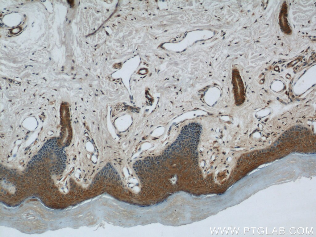 Immunohistochemistry (IHC) staining of human skin tissue using MAGED1 Polyclonal antibody (22053-1-AP)