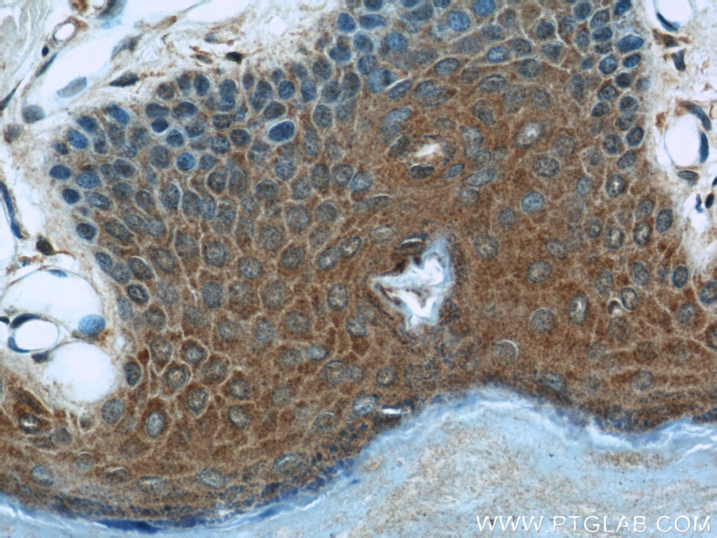 Immunohistochemistry (IHC) staining of human skin tissue using MAGED1 Polyclonal antibody (22053-1-AP)