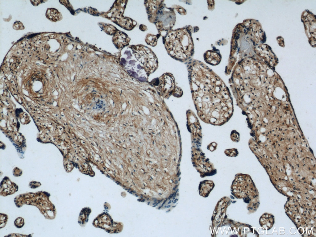 Immunohistochemistry (IHC) staining of human placenta tissue using MAGED1 Polyclonal antibody (22053-1-AP)