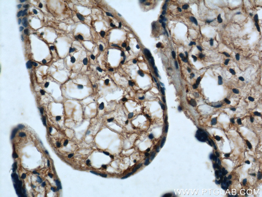 Immunohistochemistry (IHC) staining of human placenta tissue using MAGED1 Polyclonal antibody (22053-1-AP)