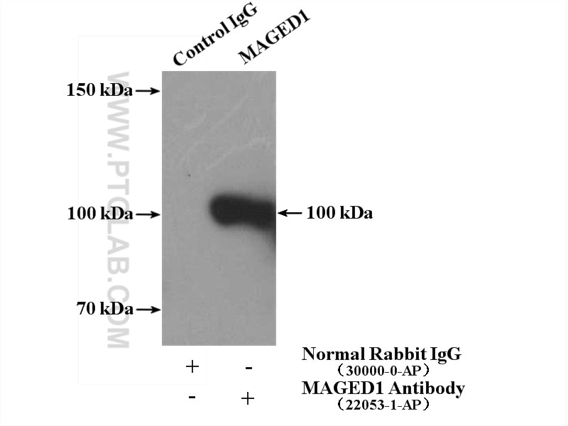 Immunoprecipitation (IP) experiment of A549 cells using MAGED1 Polyclonal antibody (22053-1-AP)
