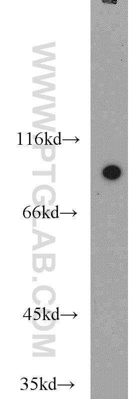 Western Blot (WB) analysis of mouse placenta tissue using MAGED1 Polyclonal antibody (22053-1-AP)