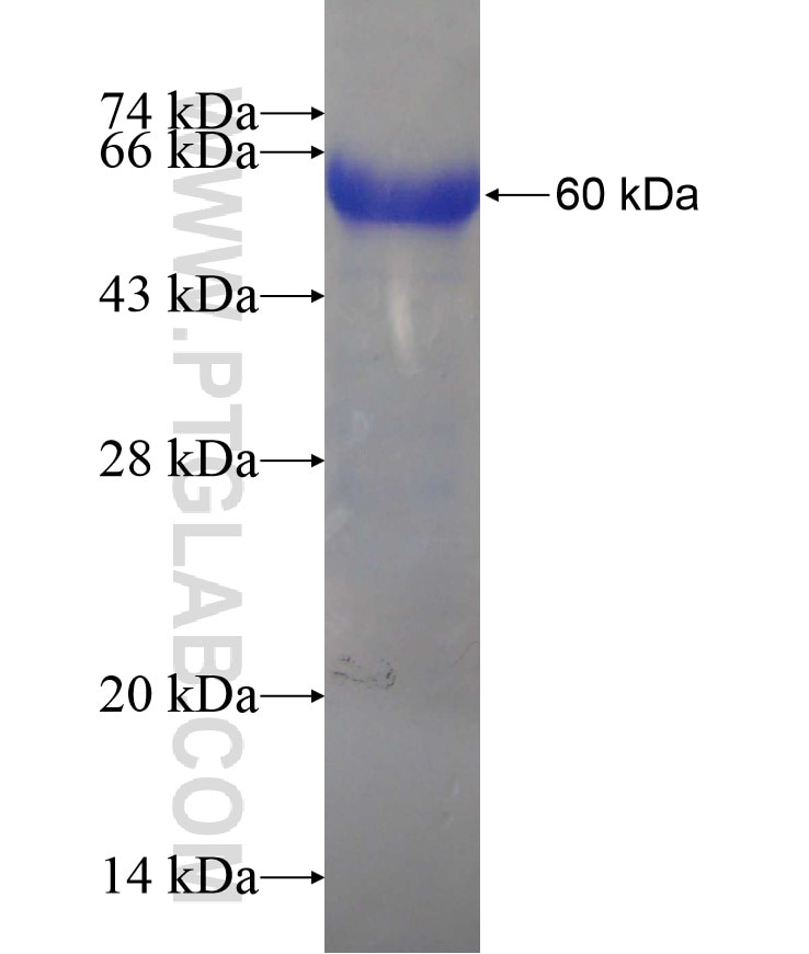 MAGED1 fusion protein Ag17465 SDS-PAGE