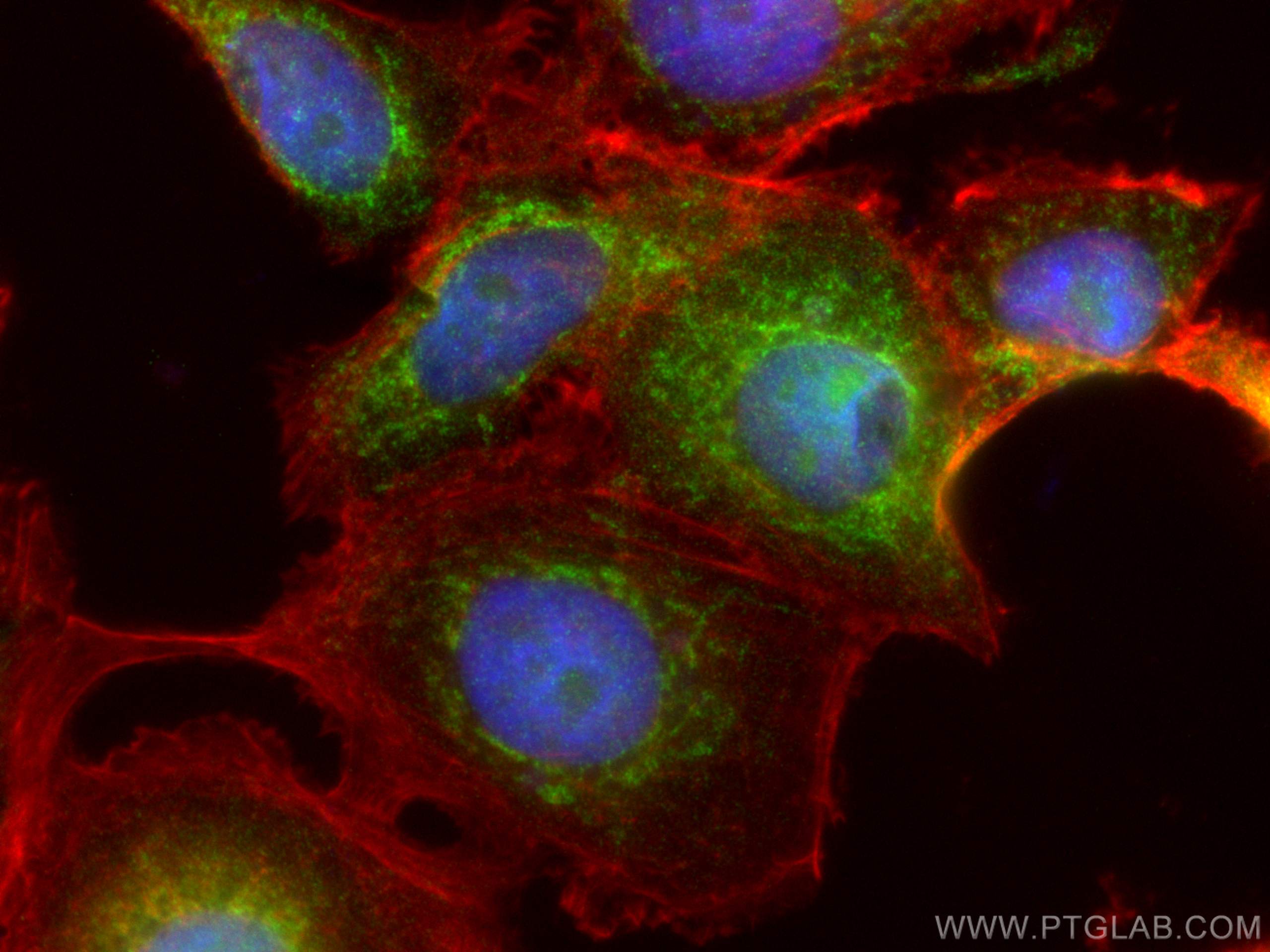 Immunofluorescence (IF) / fluorescent staining of MCF-7 cells using MAGED2 Polyclonal antibody (15252-1-AP)