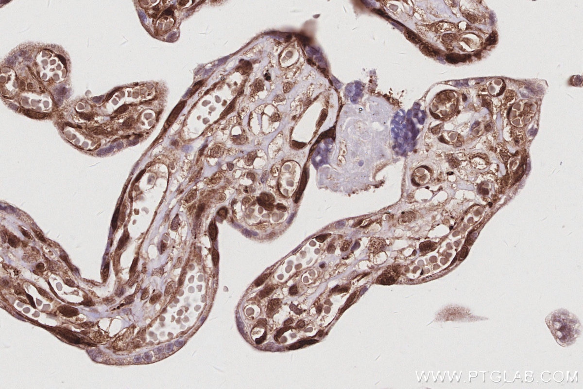 Immunohistochemistry (IHC) staining of human placenta tissue using MAGED2 Polyclonal antibody (15252-1-AP)