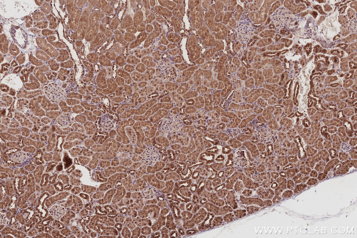 Immunohistochemistry (IHC) staining of rat kidney tissue using MAGED2 Polyclonal antibody (15252-1-AP)