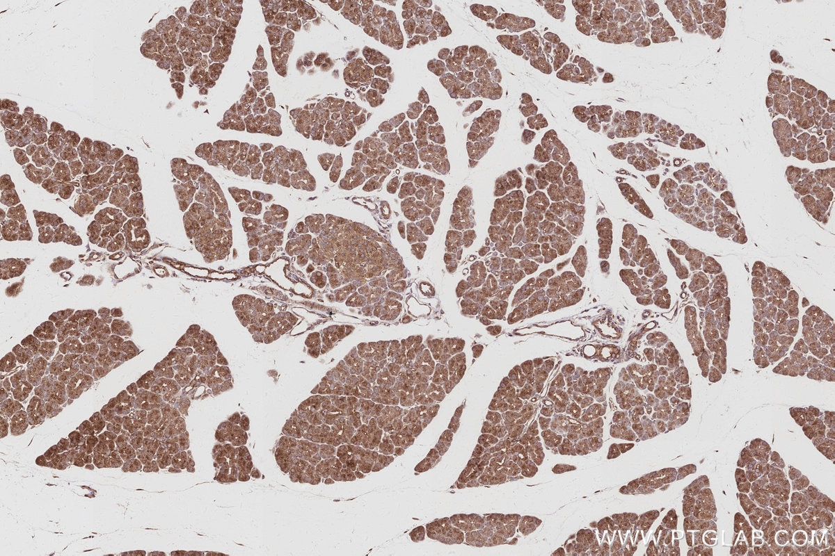 Immunohistochemistry (IHC) staining of rat pancreas tissue using MAGED2 Polyclonal antibody (15252-1-AP)