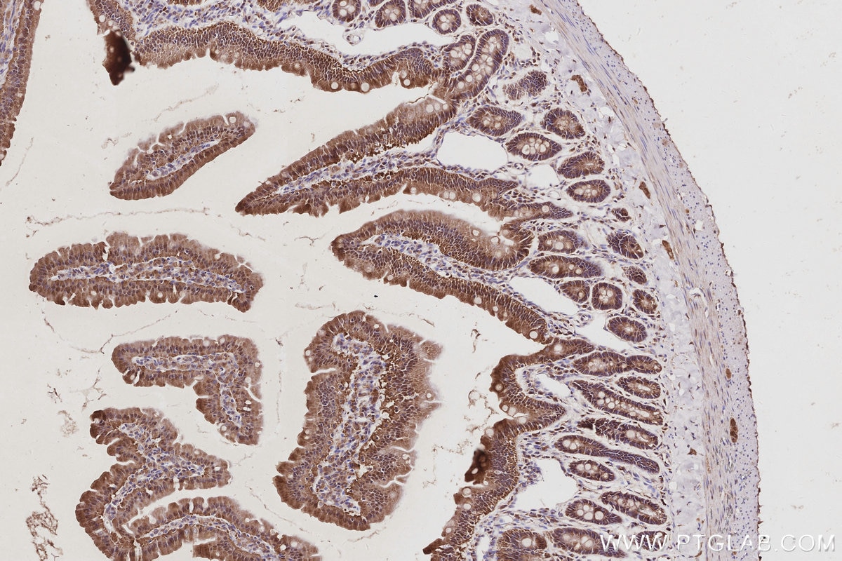Immunohistochemistry (IHC) staining of rat small intestine tissue using MAGED2 Polyclonal antibody (15252-1-AP)