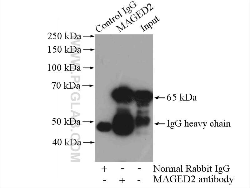 Immunoprecipitation (IP) experiment of HepG2 cells using MAGED2 Polyclonal antibody (15252-1-AP)