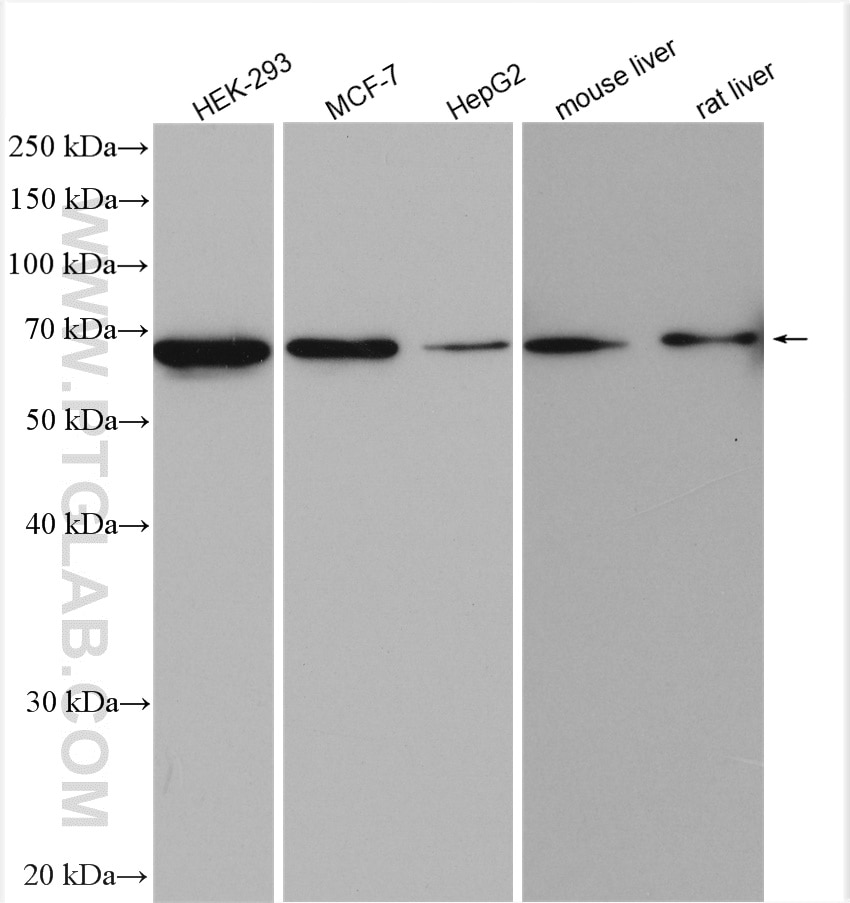 Western Blot (WB) analysis of various lysates using MAGED2 Polyclonal antibody (15252-1-AP)