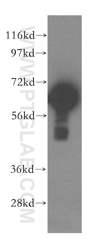 Western Blot (WB) analysis of HepG2 cells using MAGED2 Polyclonal antibody (15252-1-AP)