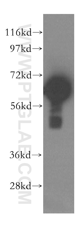 WB analysis of HepG2 using 15252-1-AP