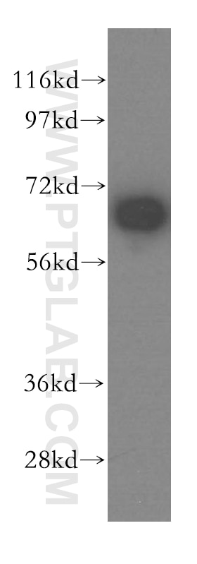 Western Blot (WB) analysis of A431 cells using MAGED2 Polyclonal antibody (15252-1-AP)