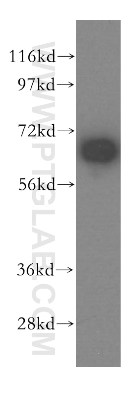 WB analysis of A431 using 15252-1-AP