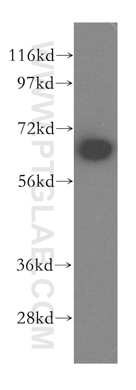 Western Blot (WB) analysis of MCF-7 cells using MAGED2 Polyclonal antibody (15252-1-AP)