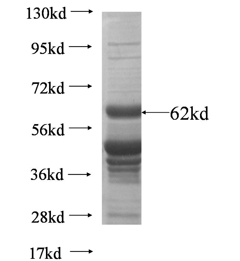 MAGED2 fusion protein Ag6828 SDS-PAGE