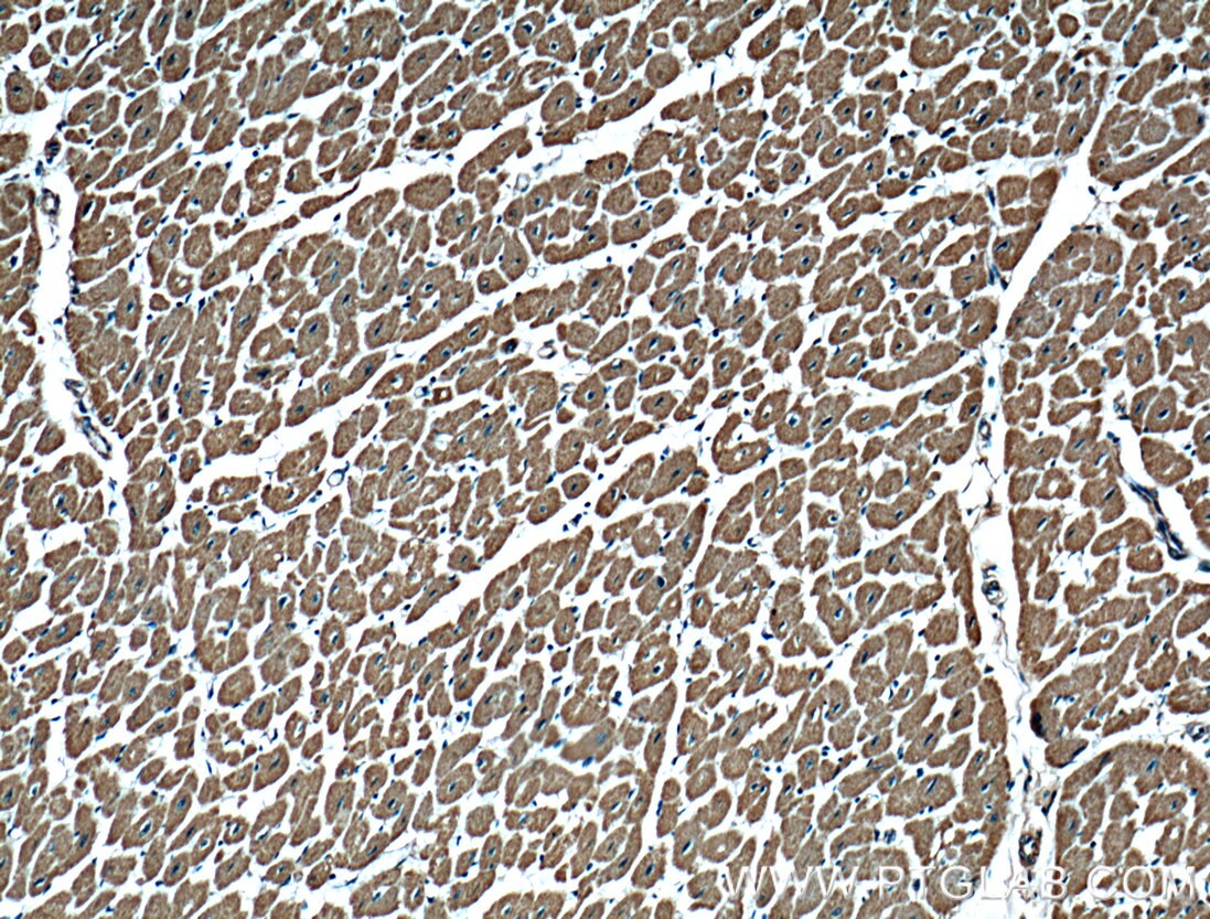 Immunohistochemistry (IHC) staining of human heart tissue using MAGED4 Polyclonal antibody (16809-1-AP)