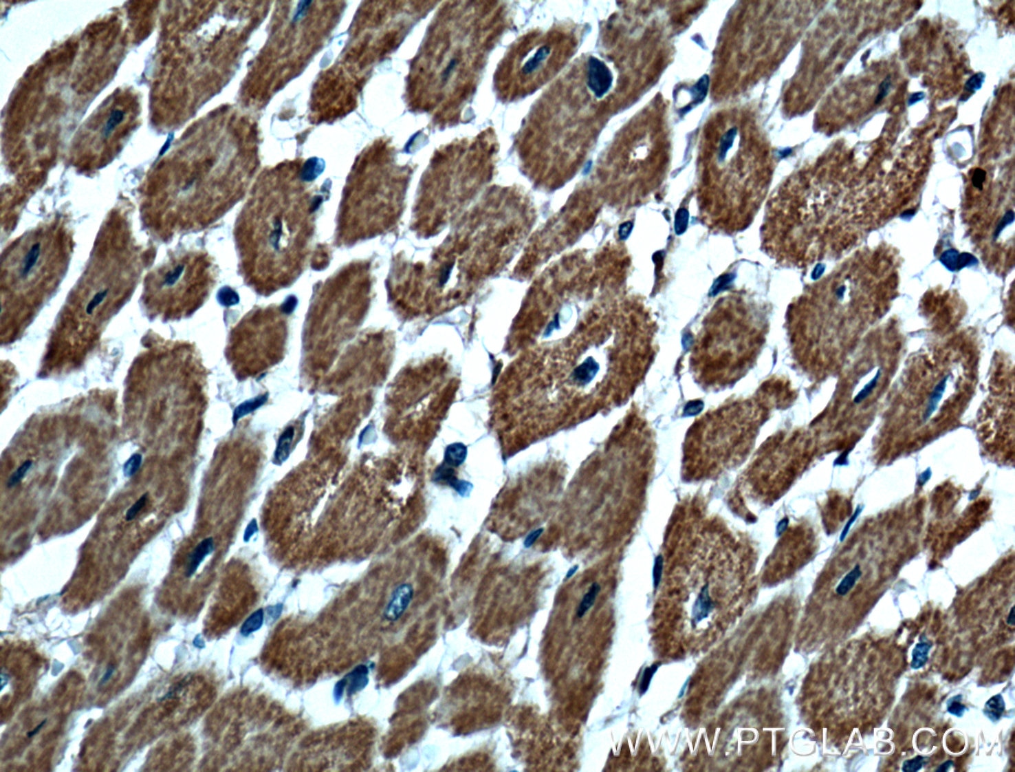 Immunohistochemistry (IHC) staining of human heart tissue using MAGED4 Polyclonal antibody (16809-1-AP)